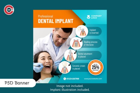 Visual Tools for Dental Implant Education